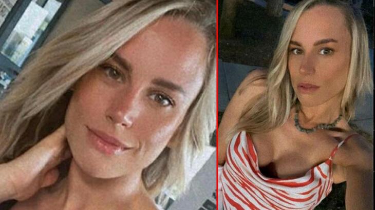 Etiler’de dehşet veren olay! Köpek kadın mimarın kulağını kopardı