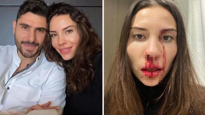 Şiddet gerekçesiyle Özer Hurmacı’dan şikayetçi olan Mihriban Hurmacı: 500 TL ile ortada kaldım