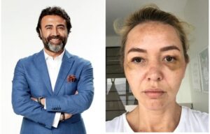 Sosyal medya hesabından erkek vahşeti için “Artık Susma!” diyen Dr Nihat Dik’den 2 yaşındaki kızına ve sevgilisine dayak!!!