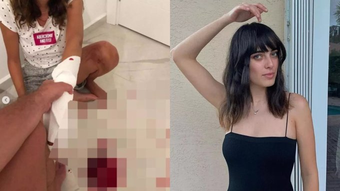 Fenomen İrem Ay’a Eski Eşi Berkay Saner’den Kan Donduran Tehditler!