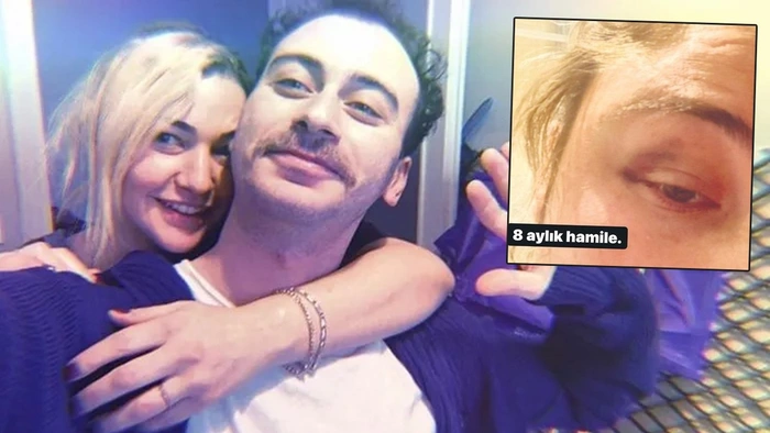 Kaan Boşnak’ın eşinden yeni iddia: “Bebek beklerken bile dövdü”