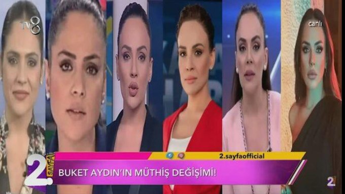 Buket Aydın Hiç estetiğim yok dedi eski fotoğrafları gösterilince estetikleri tek tek itiraf etti