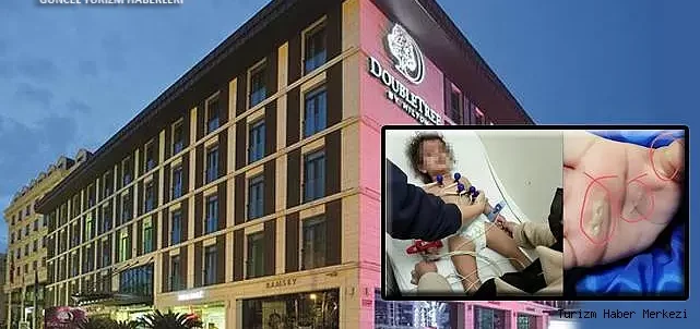 İstanbul’daki 5 yıldızlı otelin müdürüne taksirle yaralama suçundan ceza!