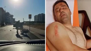 Survivor yarışmacısı, başcazgırı hastanelik etti!