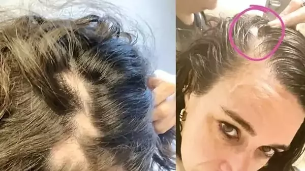 İş insanı Yasemin Sadıkoğlu gece kulübünde saldırıya uğradı, darp raporu aldı