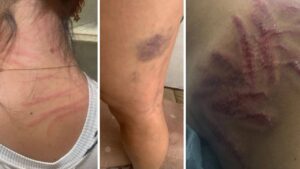 Eski bakan Muammer Güler’in yeğenine güzellik merkezinde saldırı