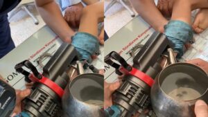 Parkta bulup ayağına taktı, imdadına itfaiye yetişti