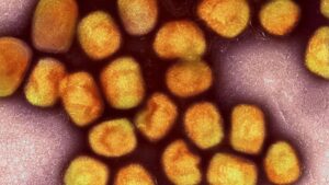 Bir ülkede daha mpox tespit edildi: Hasta BAE’den gitmiş