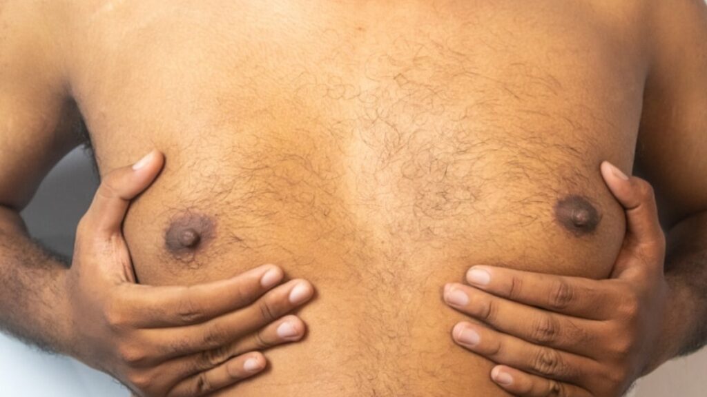 Jinekomasti nedir? Erkeklerde göğüs büyümesinin nedenleri nelerdir?