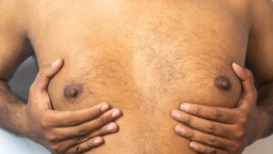 Jinekomasti nedir? Erkeklerde göğüs büyümesinin nedenleri nelerdir?