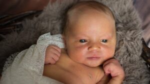 Yenidoğanlarda sarılık nedir?