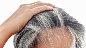 Beyaz saçlar genetik olmayabilir! Saçlarınız hızla beyazlıyorsa sebebi yemedikleriniz olabilir