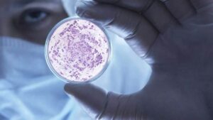 Süper bakteri krizi derinleşiyor: Antibiyotikler işlemiyor