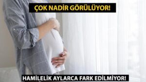 Kriptik hamilelik nedir, ne demek? Kriptik hamilelik nedenleri ve belirtileri nelerdir?