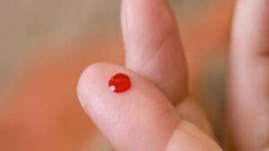 Ne Kadar Kan Abdesti Bozar? Vücut Ne Kadar Kanarsa Abdest Bozulur?