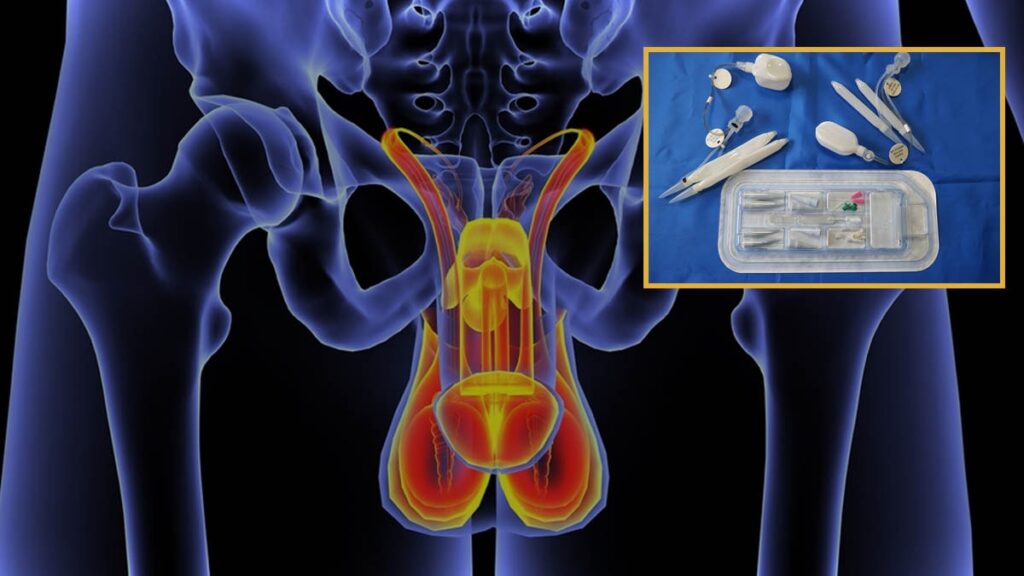 Penisi 10 santim kesildi: ‘Çoğu insan bu virüse yakalanacak’ dedi ve uyardı!