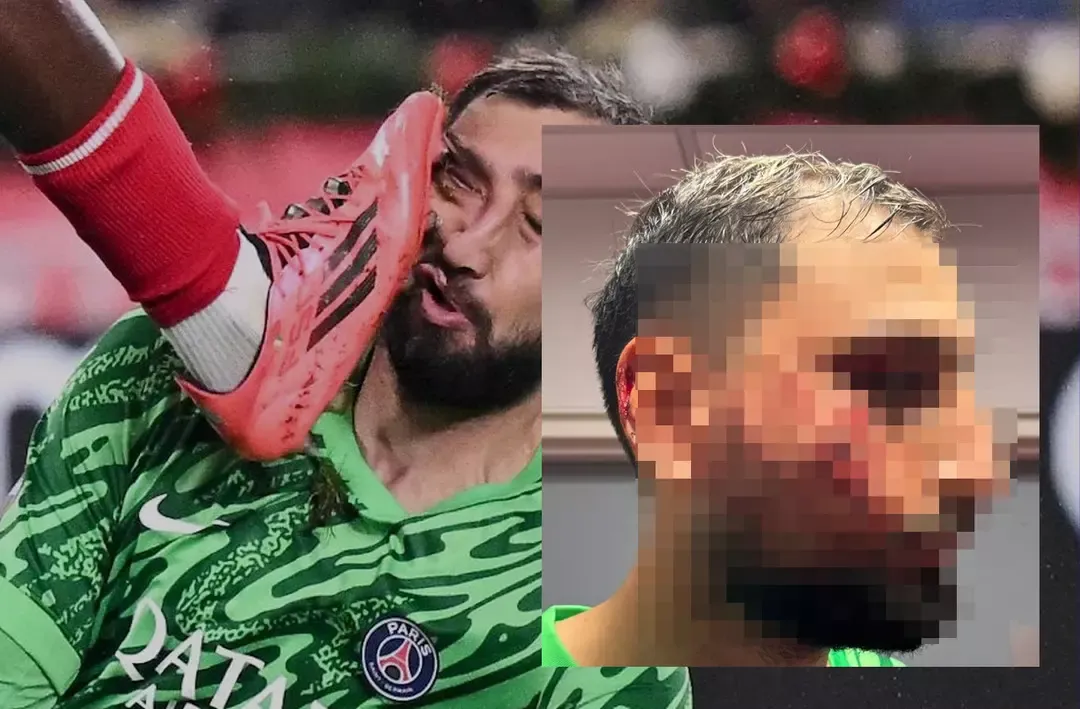 Dünya dün geceki bu faulu konuşuyor