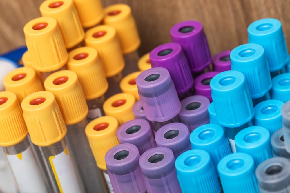 En çok para kazanan kan grubu oymuş