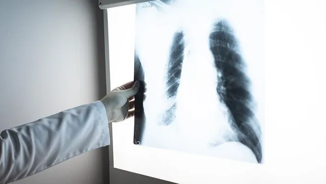 Güral Porselen'de silikozise yakalanan işçiler 13 yıldır adalet bekliyor: Tek isteğimiz biz ölmeden davamızın bitmesi