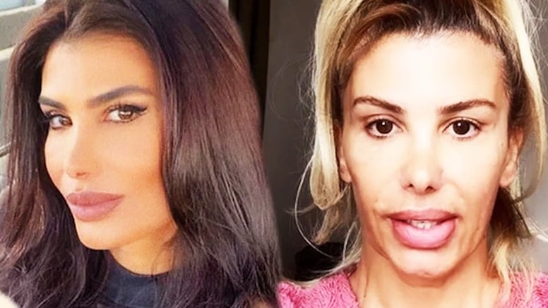 Botokstan zehirlenen şarkıcının zor günleri… ‘Olağan dışı bir şey yaşıyorum’