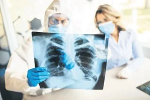 Dünya nüfusunun üçte biri verem mikrobu taşıyor