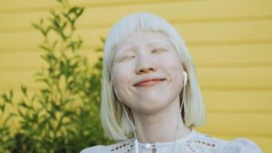 Albino Nedir, Neden Olur? Albino Tedavisi Var Mıdır?