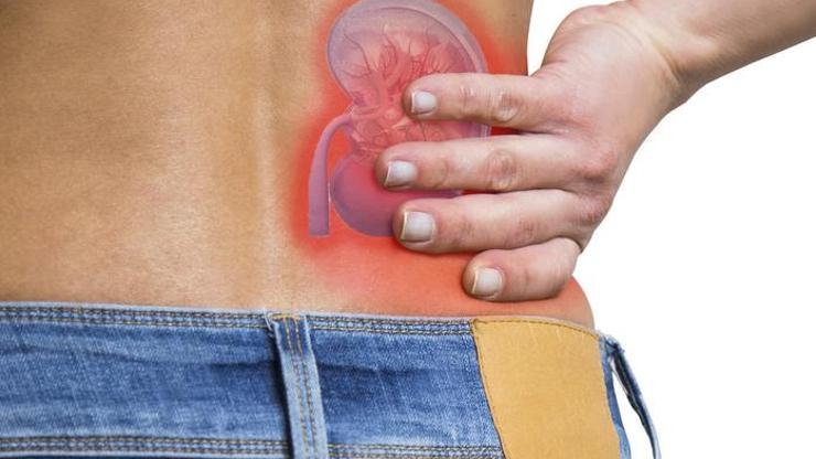 Böbrek Üşütmesi Belirtileri Nelerdir? Böbrek Üşütmesi Nasıl Anlaşılır? Tedavi Yöntemleri Nelerdir?