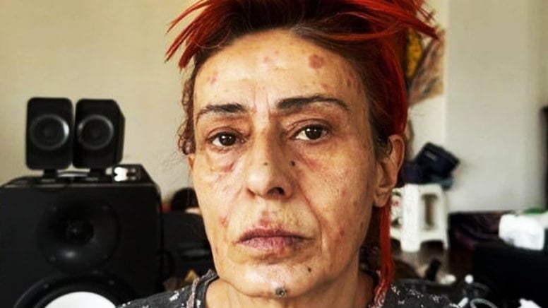 Yıldız Tilbe’den kökten çözüm