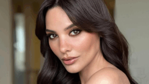 ‘Ne botoks ne dolgu var’ demişti: Güzel oyuncunun estetiksiz hali ortaya çıktı