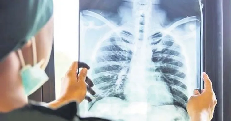 Zatürre uyarısı ‘beşinci ölüm nedeni’