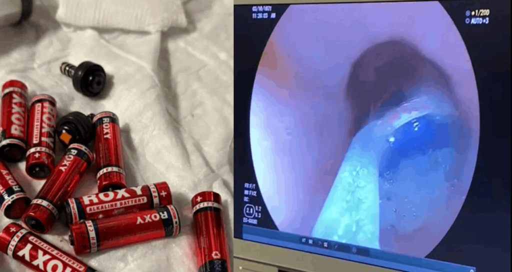 Cezaevinde korkunç olay: 9 pil, 3 jilet yuttu!