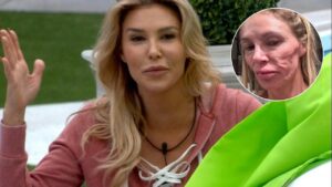 Ünlü televizyon yıldızının yüzü tanınmaz hale geldi! Teşhis konulana kadar 130 bin dolar harcadı