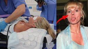 Ünlü yıldızın burun kemiği yok oldu